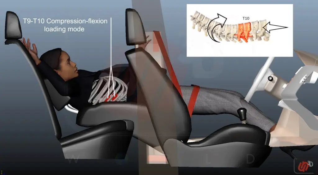 Defective Seatbacks - Seatback Collapse - Animation