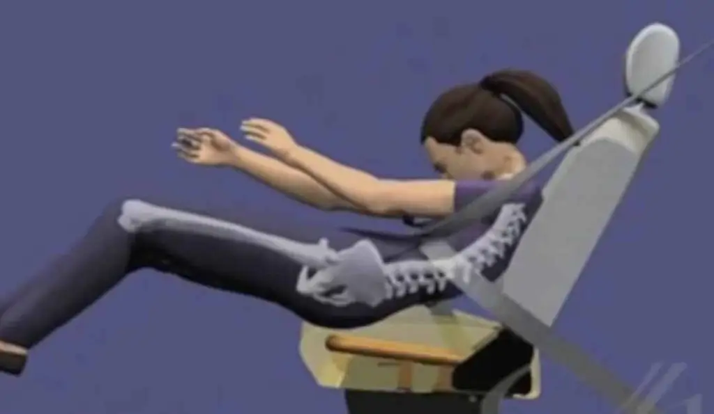 Medical Graphic of Seat Belt Submarining